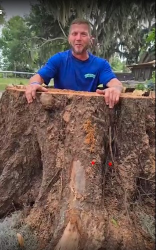 Jason with massive stump